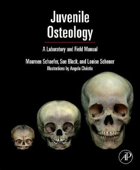  Juvenile Osteology 