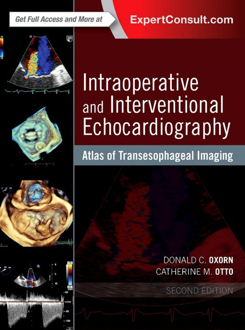  Intraoperative and Interventional Echocardiography 
