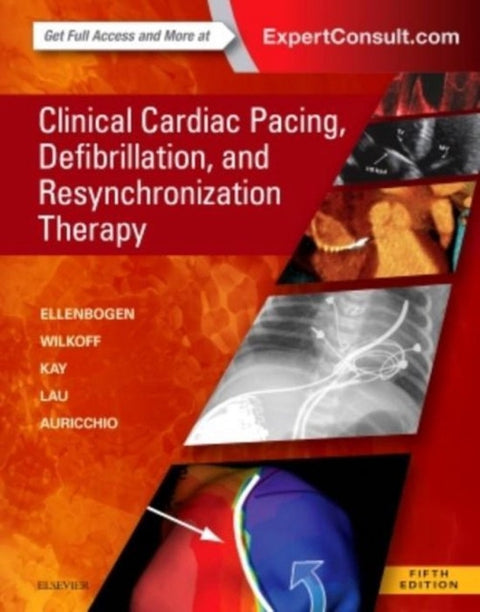  Clinical Cardiac Pacing, Defibrillation and Resynchronization Therapy 