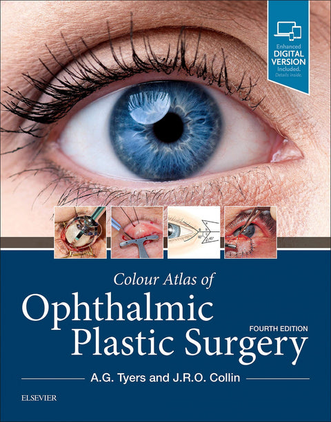  Colour Atlas of Ophthalmic Plastic Surgery 