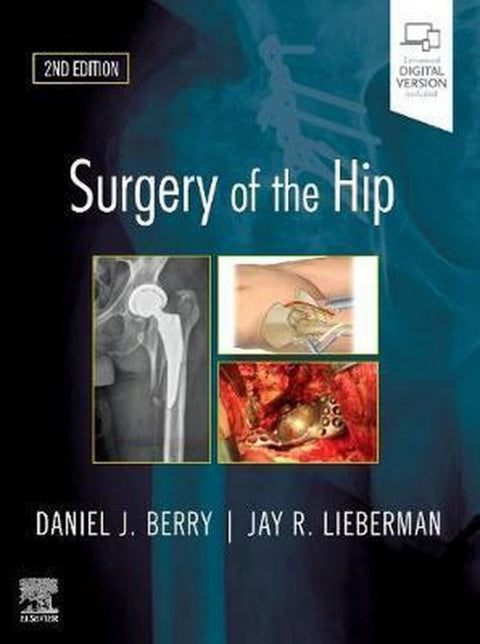  SURGERY OF THE HIP 