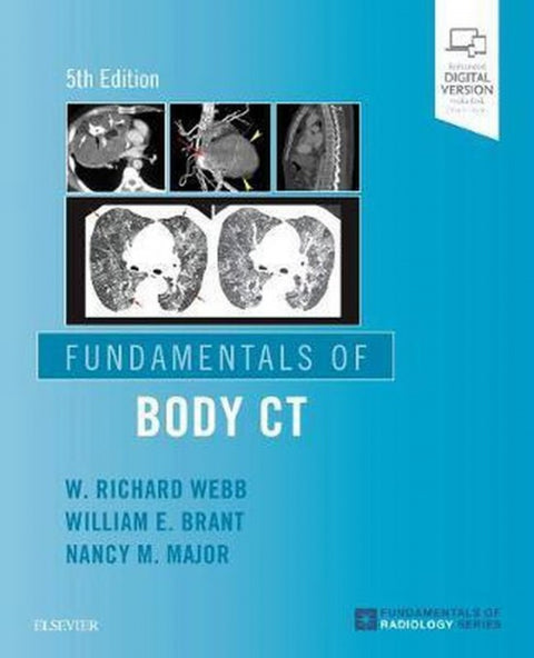  FUNDAMENTALS OF BODY CT 