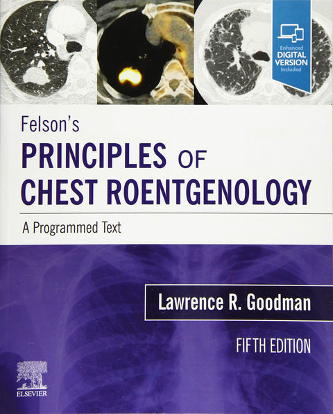  FELSON´S PRINCIPLES OF CHEST ROENTGENOLOGY A PROGRAMMED 