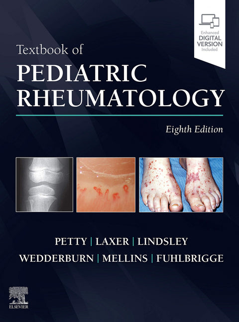  Textbook of pediatric rheumatology 