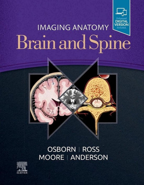  Imaging anatomy brain and spine 
