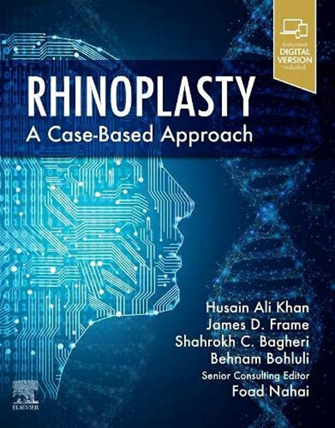  RHINOPLASTY 