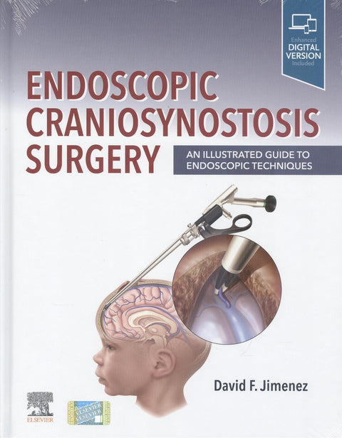  Endoscopic Craniosynostosis Surgery 