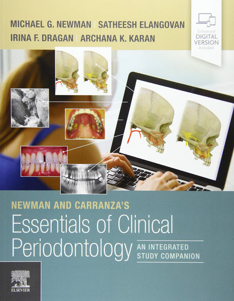  NEWMAN AND CARRANZA'S ESSENTIALS OF CLINICAL PERIODONTOLOGY 