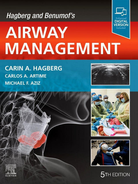  Hagberg and benumof´s airway management 