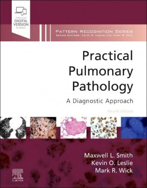  Practical pulmonary pathology 
