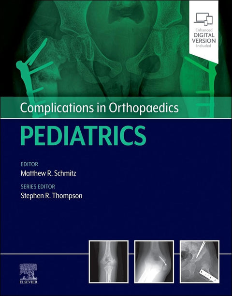  Complications in orthopaedics:pediatrics 
