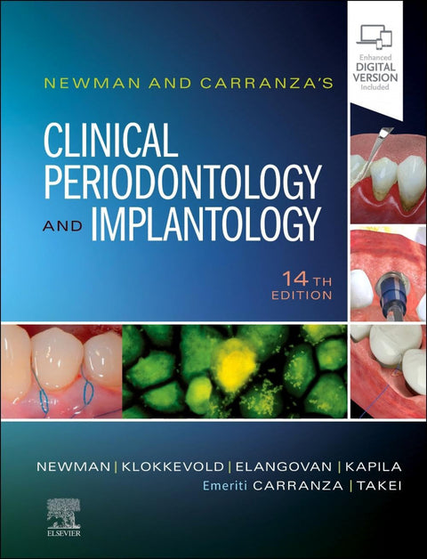  Newman and carranza's clinical periodontology implantology 