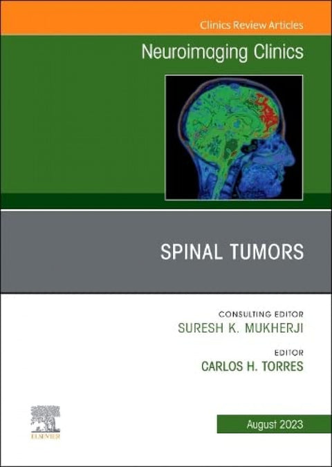  SPINAL TUMORS, AN ISSUE OF NEUROIMAGING CLINICS OF NORTH 