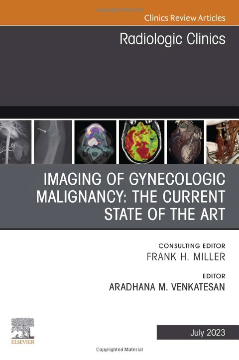  Imaging of gynecologic malignancy: the current state of the 