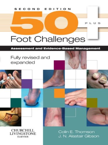  50+ FOOT CHALLENGES 