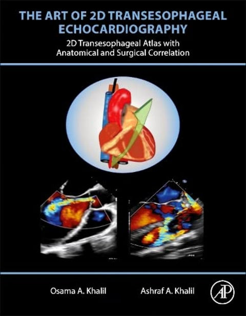  The art of 2d transesphageal echocardiography 
