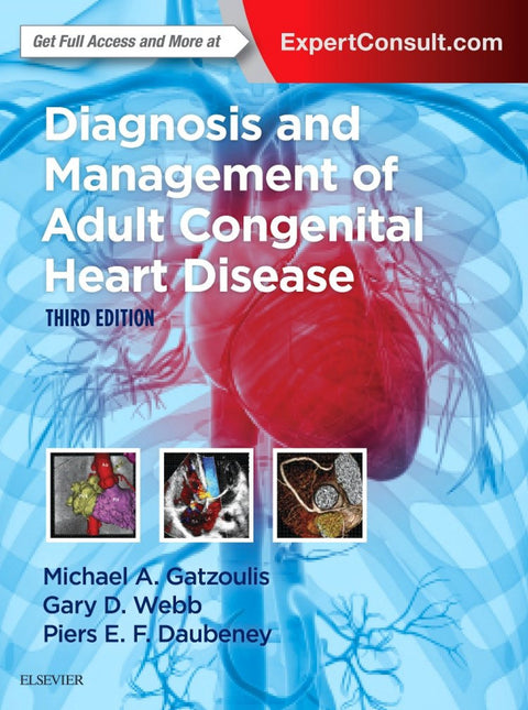  Diagnosis and Management of Adult Congenital Heart Disease 