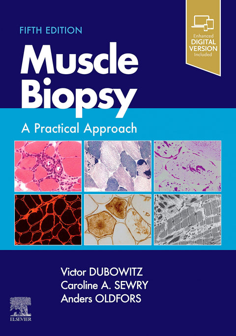  Muscle biopsy:a practical approach 