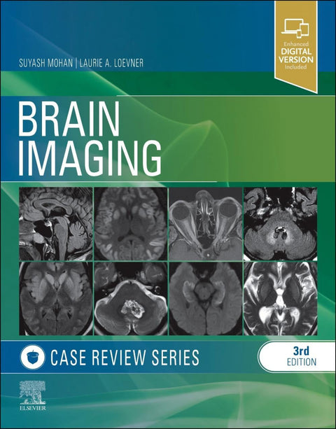  Brain imaging:case review series 