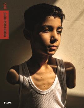  World Press Photo 2025 