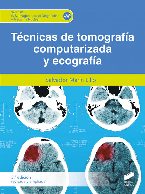  TECNICA DE TOMOGRAFIA COMPUTARIZADA Y ECOGRAFIA 3A EDICION REVISADA 