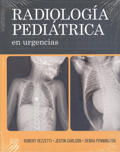  RADIOLOGIA PEDIATRICA EN URGENCIAS 