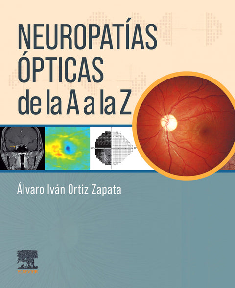  Neuropatías ópticas de la A a la Z 