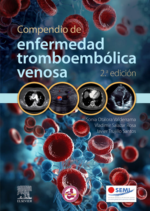  COMPENDIO DE ENFERMEDAD TROMBOEMBOLICA VENOSA 2ª ED 