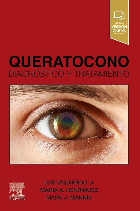  QUERATOCONO 