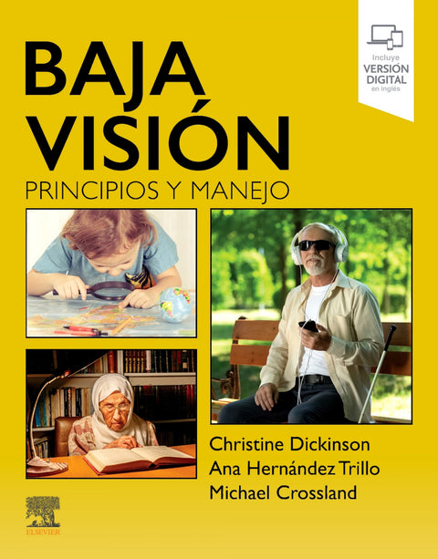  Baja vision 