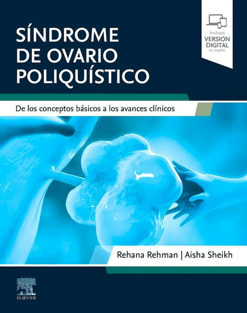  SINDROME DE OVARIO POLIQUISTICO 