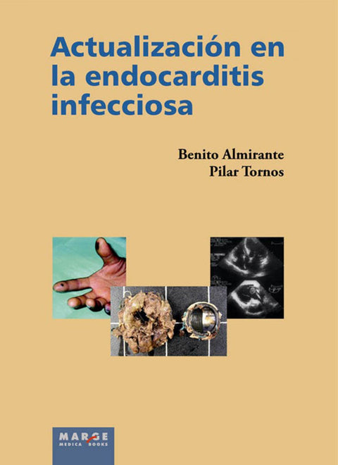  ACTUALIZACION EN LA ENDOCARDITIS INFECCIOSA 