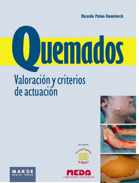  QUEMADOS. VALORACION Y CRITERIO 