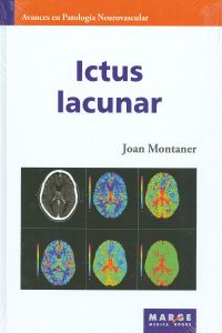  ICTUS LACUNAR 