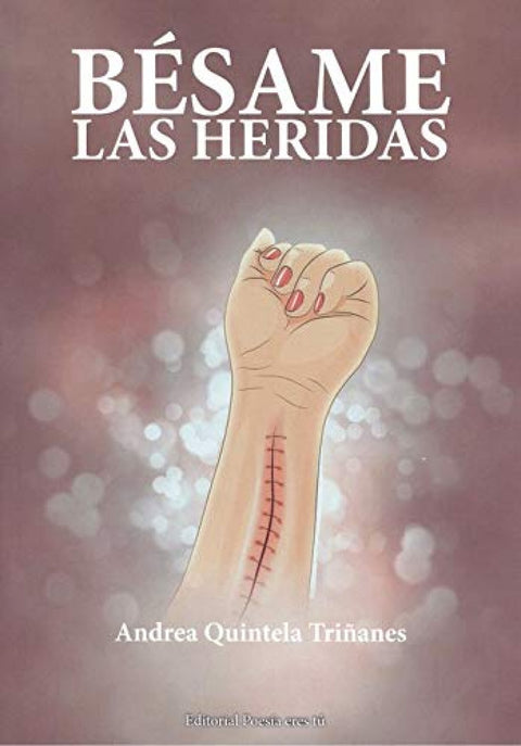  BESAME LAS HERIDAS 
