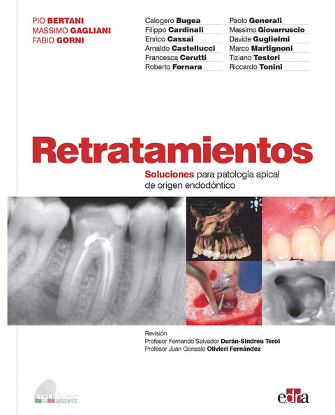  Retratamientos. Soluciones para patología apical de origen endodóntico 