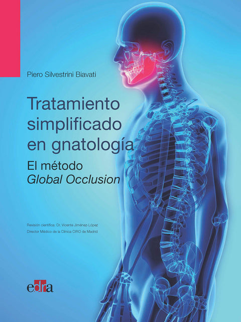  Oclusión global. Tratamiento simplificado en gnatología 
