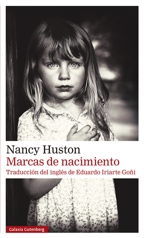  Marcas de nacimiento 