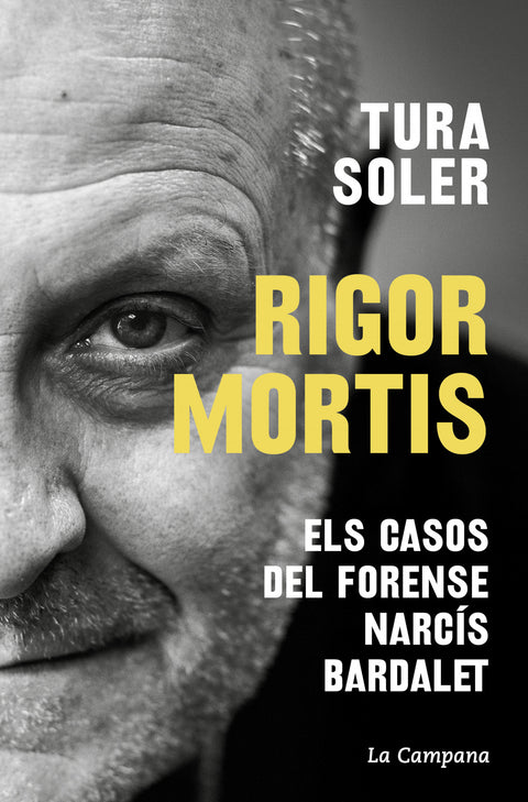  Rigor mortis 