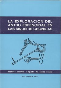  la exploración del antro esfenoidal en las sinusitis crónicas 