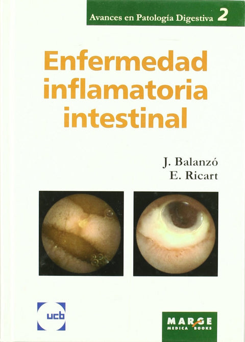  Enfermedad inflamatoria intestinal 