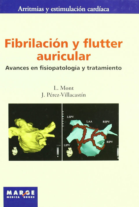  Fibrilación y flutter auricular 
