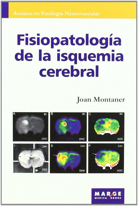  Fisiopatología de la isquemia cerebral 