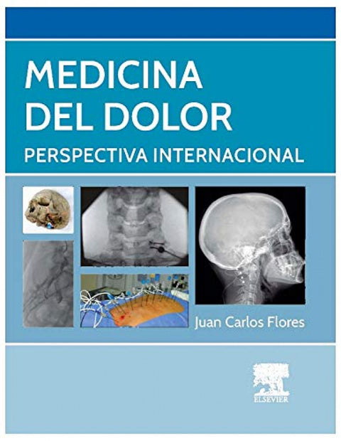  Medicina del dolor 