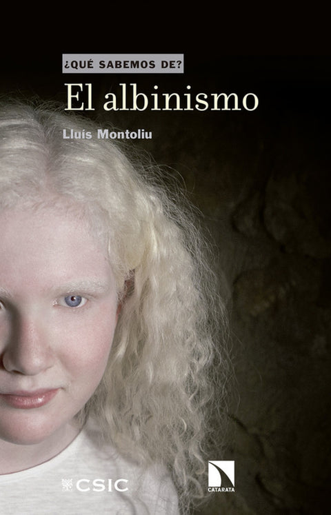  EL ALBINISMO 