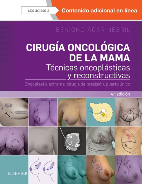  CIRUGÍA ONCOLÓGICA DE LA MAMA 
