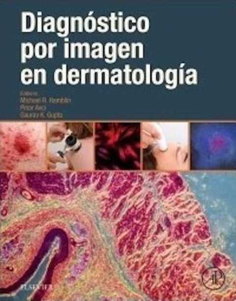  DIAGNÓSTICO POR IMAGEN EN DERMATOLOGÍA 