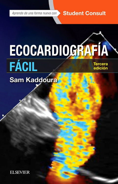  ECOCARDIOGRAFÍA FÁCIL + STUDEN CONSULT 