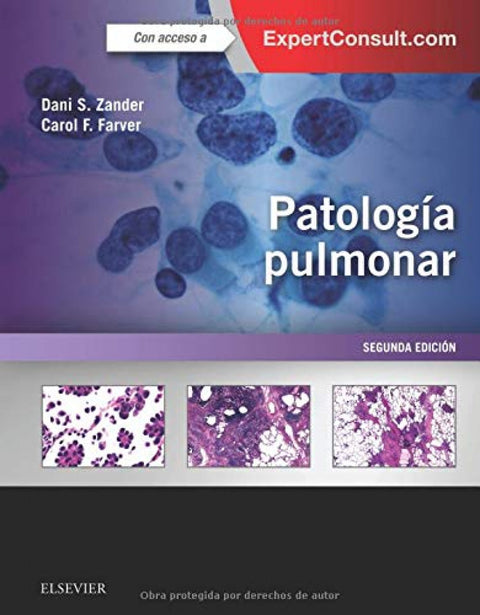  PATOLOGÍA PULMONAR +EXPERTCONSULT 