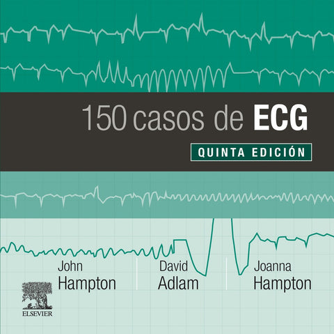  150 CASOS DE ECG 